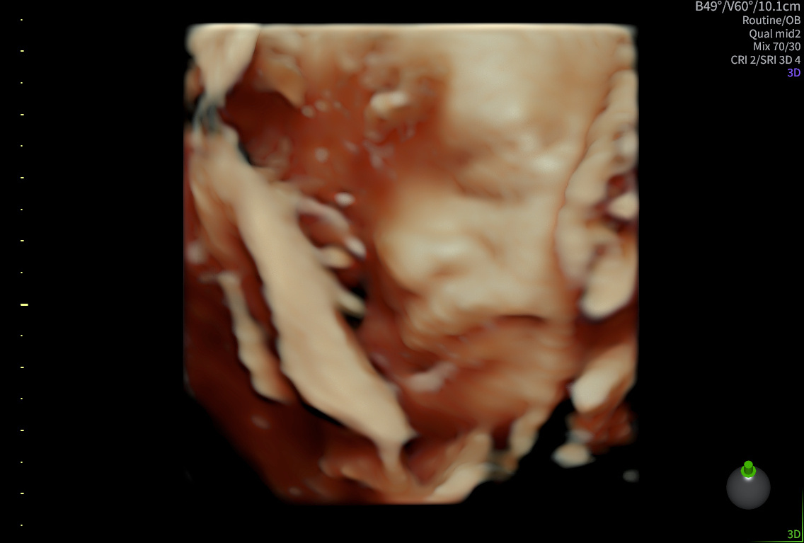 3D/4D-scanning i Hillerød