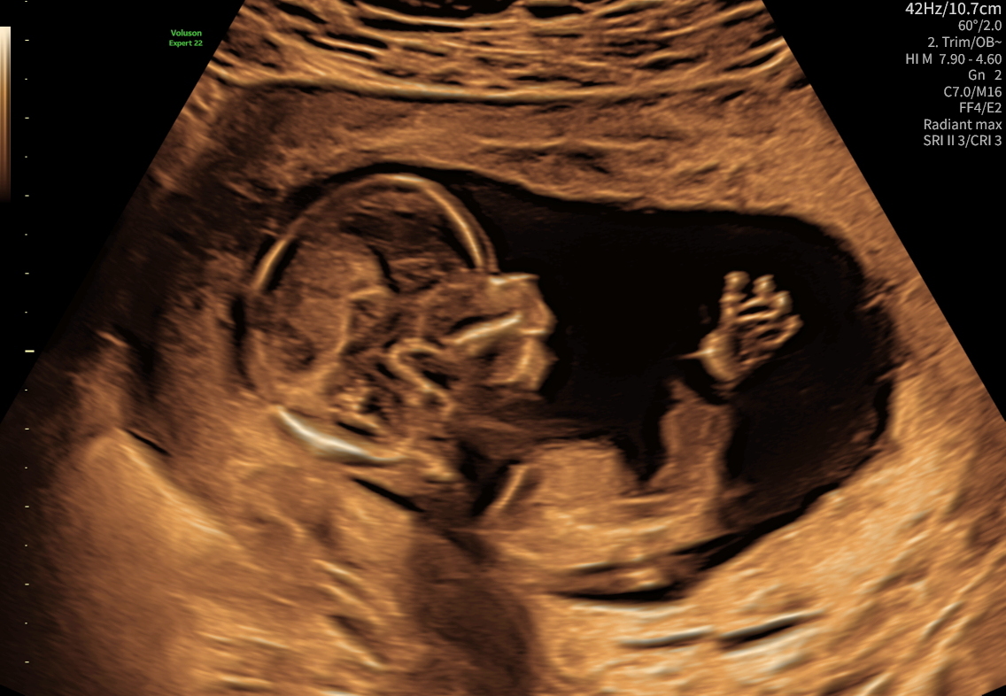 Tryghedsscanning i Hillerød hos Centrumlægerne